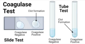 Coagulase Test- Principle, Procedure, Types, Result, Uses, Notes Coagulase-Test-notes