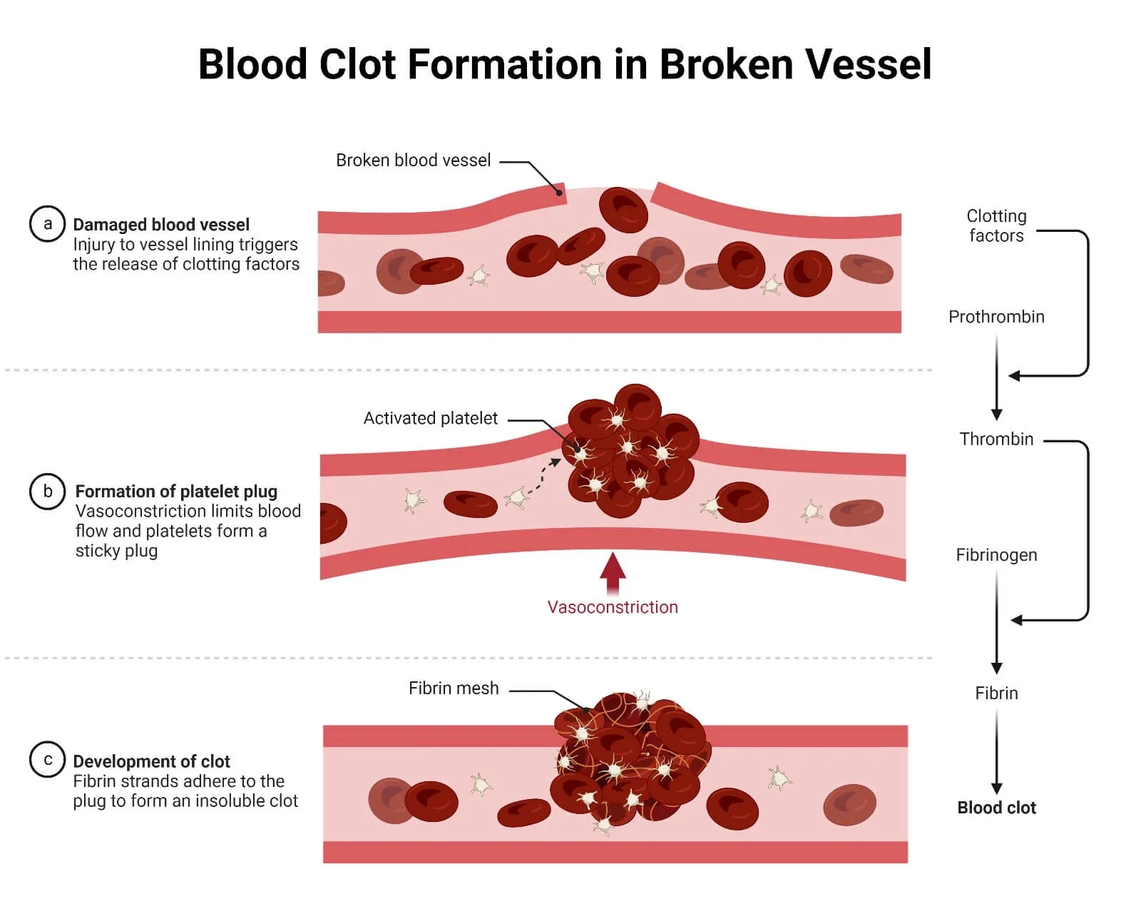 Clotting-factors-Blood-Clot-Formation-in-Broken-Vessel