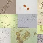 Types-of-Crystals-in-Urine