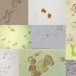 Types-of-Crystals-in-Urine