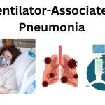 Ventilator-Associated-Pneumonia