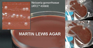 Martin-Lewis-Agar-768x403