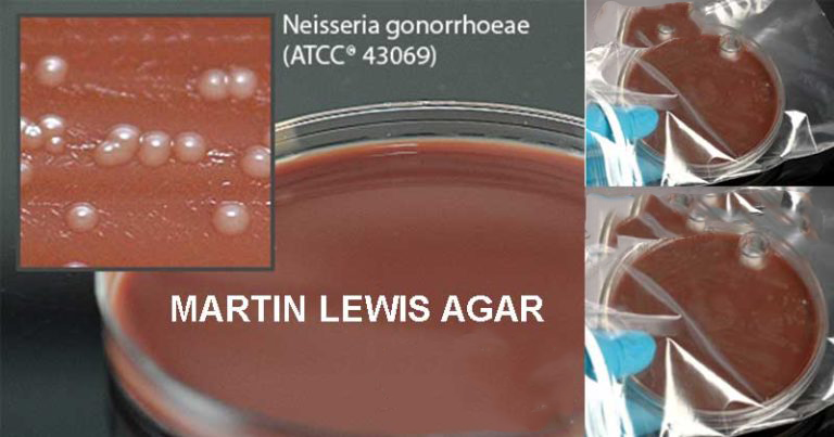 Martin-Lewis-Agar-768x403