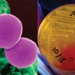 Methicillin-Resistant-Staphylococcus-aureus-MRSA-768x403