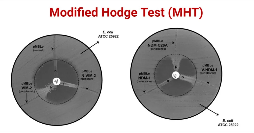 Modified-Hodge-Test-MHT-1024x536