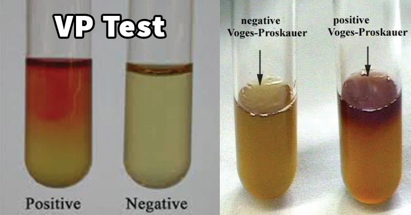 Voges-Proskauer (VP) Test: Principle, Procedure & Results