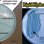 Result-Interpretation-of-Lipid-Hydrolysis-Test