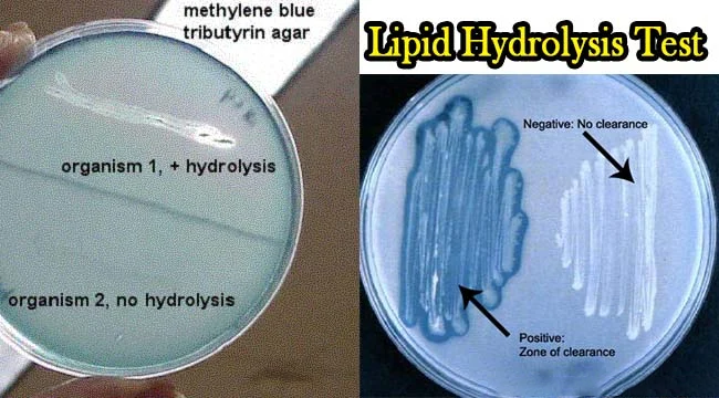Result-Interpretation-of-Lipid-Hydrolysis-Test