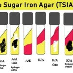 Result-Interpretation-of-TSIA-Test