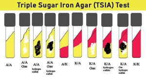 TSIA Test: Principle, Media, Procedure, Results, Uses Result-Interpretation-of-TSIA-Test