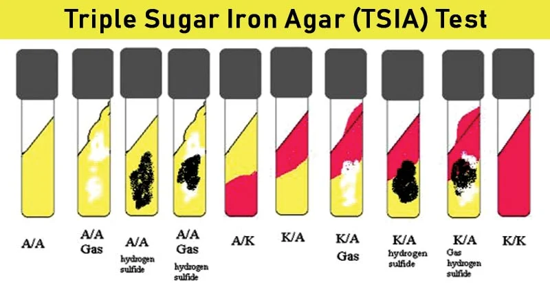 Result-Interpretation-of-TSIA-Test