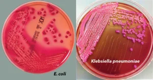 MacConkey Agar- Composition, Principle, Preparation, Results, Uses Result-Interpretation-on-MacConkey-Agar-768x403