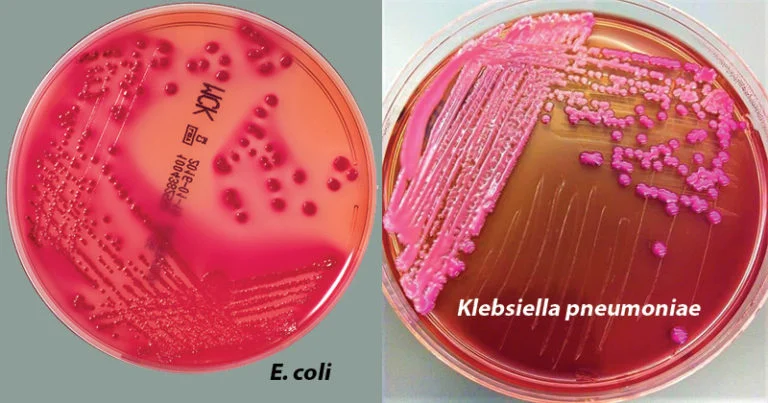 Result-Interpretation-on-MacConkey-Agar-768x403