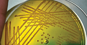 TCBS Agar- Composition, Principle, Preparation, Results, Uses Result-Interpretation-on-Thiosulfate-citrate-bile-salts-sucrose-TCBS-Agar