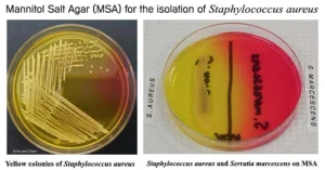 Results on Mannitol Salt Agar (MSA)
