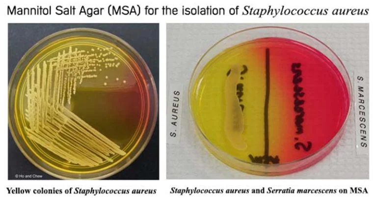 Results on Mannitol Salt Agar (MSA)