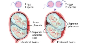 Twins zygote