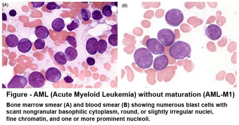 Sudan Black B Staining: Principle, Procedure, Results, Uses